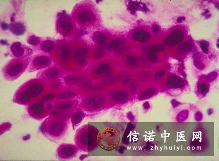 三叉神经痛同位素治疗的动物实验 三叉神经痛同位素治疗的动物实验