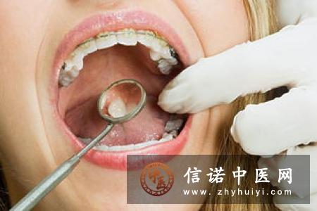 牙龈发炎的治疗措施有哪些？