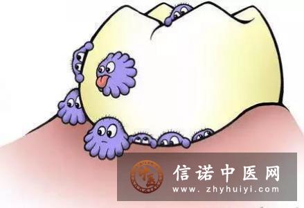 牙周病的症状有哪些你要知道
