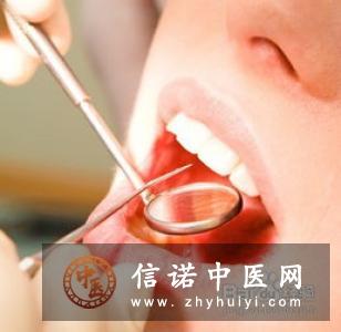 口腔溃疡的预防