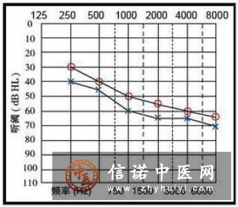 老年人如何预防听力下降 专家告诉你这样做