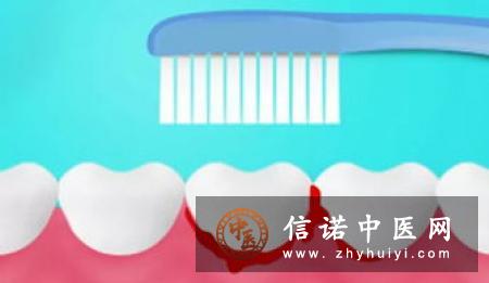 牙周病的症状有哪些你要知道